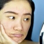 Dull-Looking Complexion